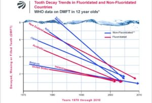 fluoridation drinking water tooth decay