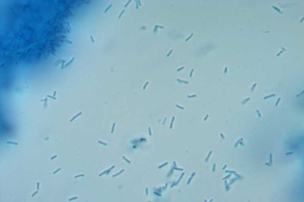 Legionella in drinking water