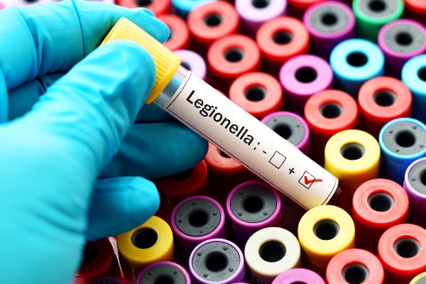 Legionella water test