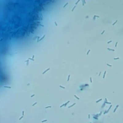 Legionella bacteria